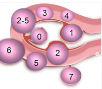 �ӹ�����˨����Ӧ֢�����У�