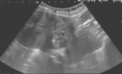 �ӹ�������΢������